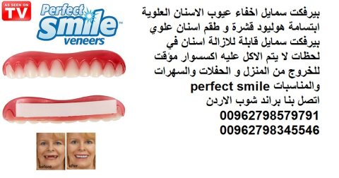Perfect Smile كيفية تركيب ابتسامة هوليود المتحركة أسنان تركيب 5