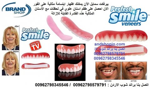أسنان جميلة وابتسامة مشرقة ! اسنان علوية القشرة المذهلة والقابلة للإزالة 2