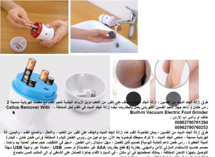 تنعيم الكعب ازالة الجلد الميت من كعب القدمين - إزالة الجلد الميت والجاف 2